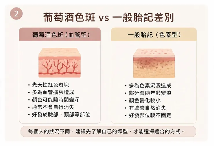葡萄酒色斑與胎記差別