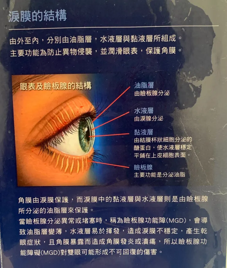 眼表及瞼板腺結構