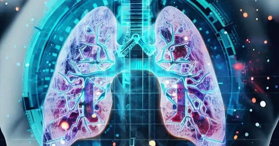 林醫師的肺癌管理學