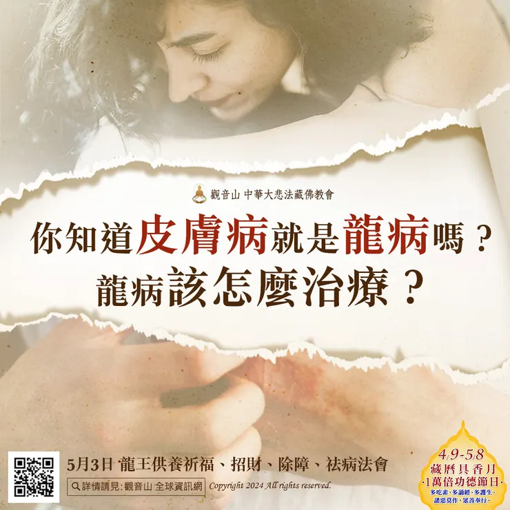 你知道皮膚病就是龍病嗎?龍病該怎麼治療?