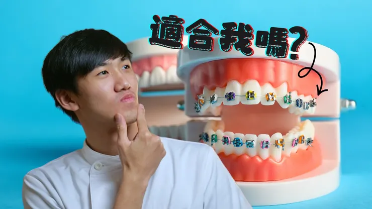 暴牙可以怎麼矯正？隱適美、傳統矯正、舌側矯正，該如何選擇最適合自己的牙齒矯正方式？
