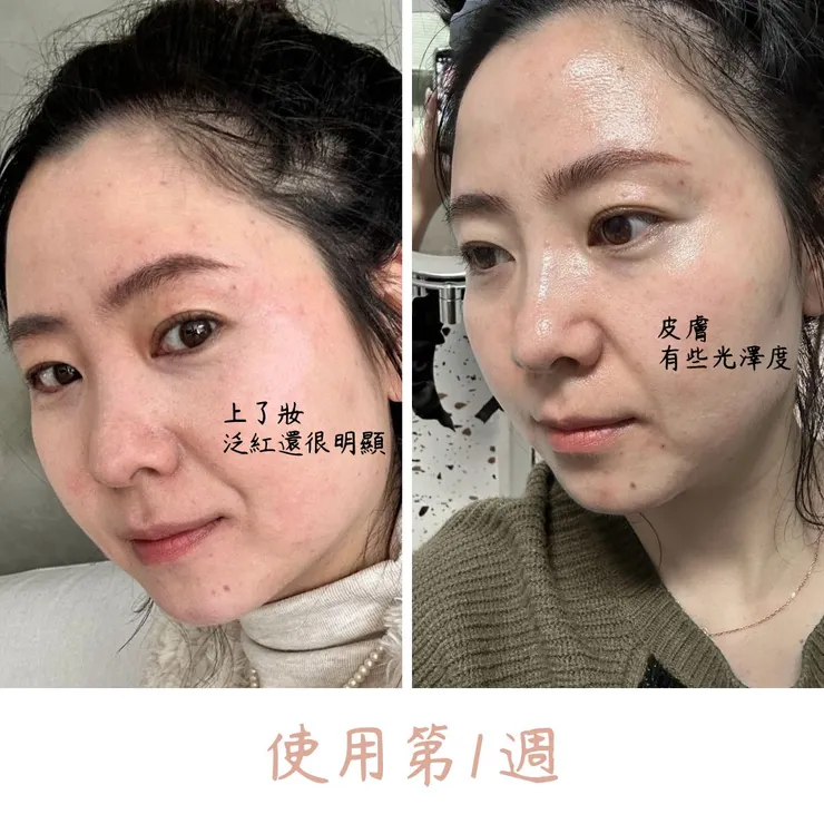 40歲敏感肌精華液使用對比