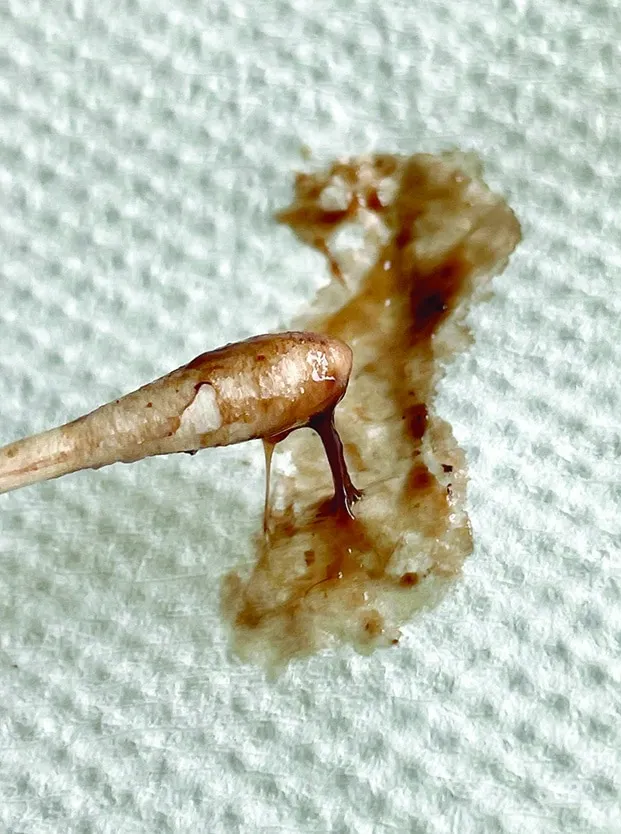 因綠膿桿菌感染而形成的分泌物及生物膜，圖片取自: todayveterinarypractice.com