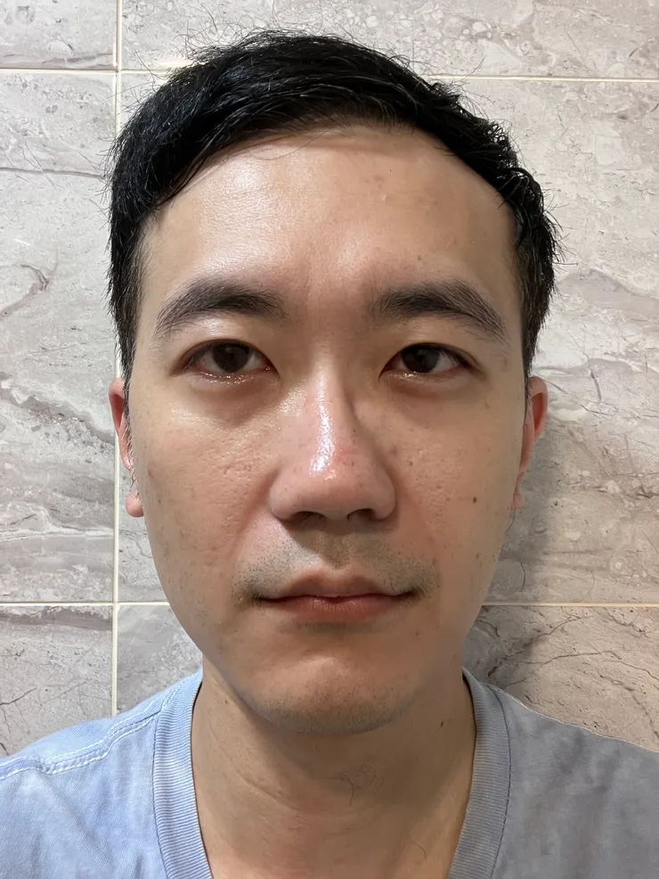膚色不均開始有改善