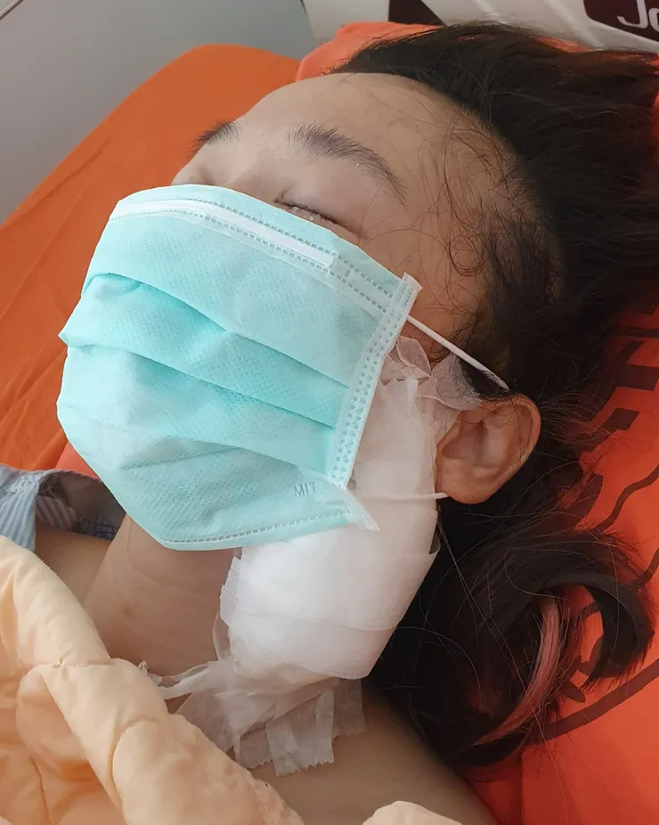 剛開完刀回到病房的卡蘿