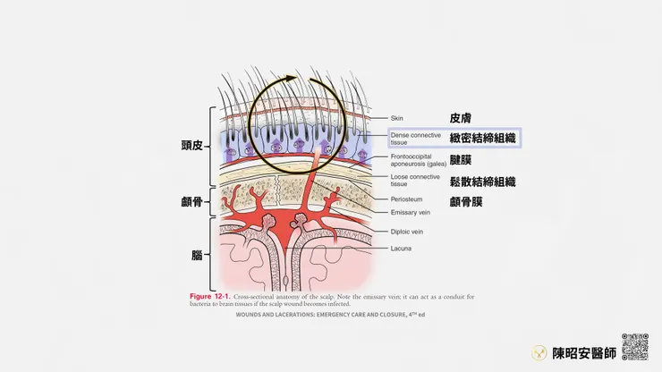頭皮縫合的關鍵是要關閉被結締組織強制打開的血管，因此針要縫到顱骨再轉彎