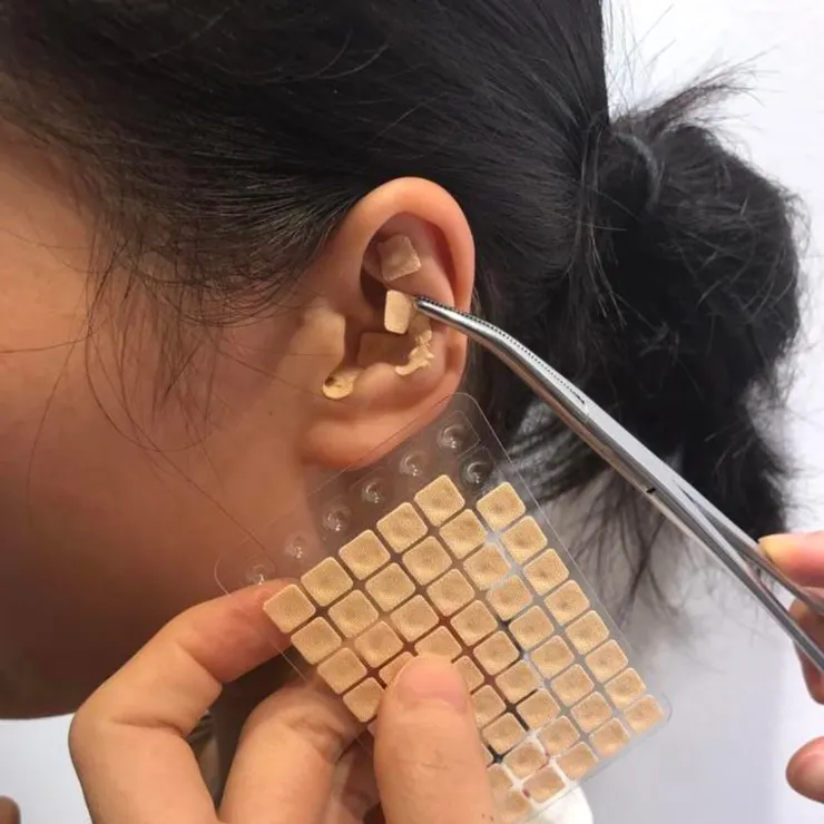傳統耳穴貼