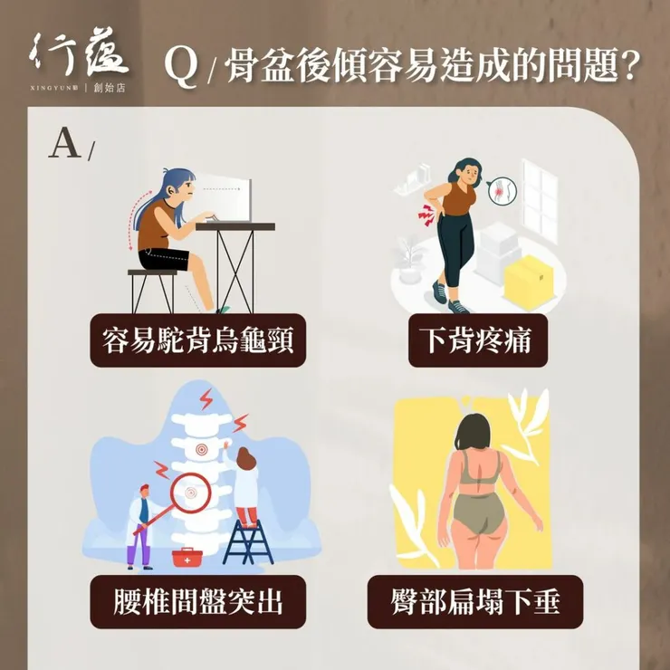 行蘊QA｜骨盆後傾容易造成的問題
