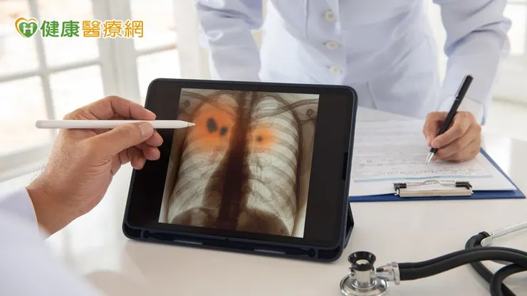 近年來，免疫藥物治療在小細胞肺癌領域開始展現希望。