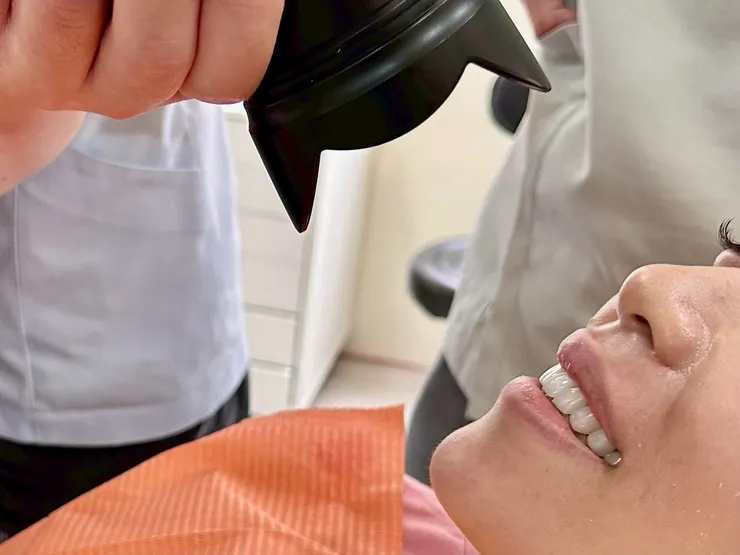 一笑傾城，氣質全開！客製化明眸鋯齒貼片(牙齒貼片)打造專屬你的自信笑容！