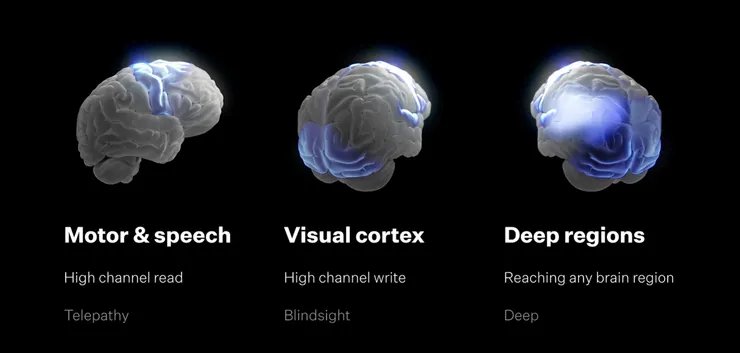 達成終極目標的三項道路：Motor、Speech、Visual cortex、Deep regions