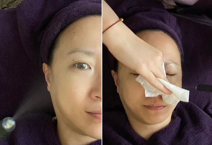 板橋美容去角質保養推薦│芮薇荷夢幻森林spa-板橋館│水飛梭氫水儀