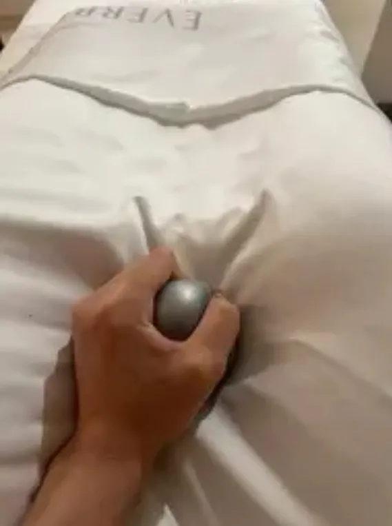 凝境美學 施打玻尿酸