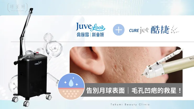 告別月球表面！『喬雅露 x 酷捷無針水光』也能打造Glass Skin？毛孔凹疤的救星！