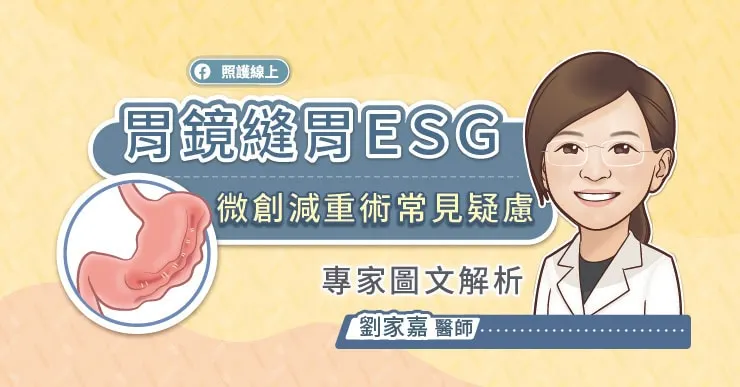 胃鏡縫胃ＥＳＧ 微創減重術常見疑慮，專家圖文解析