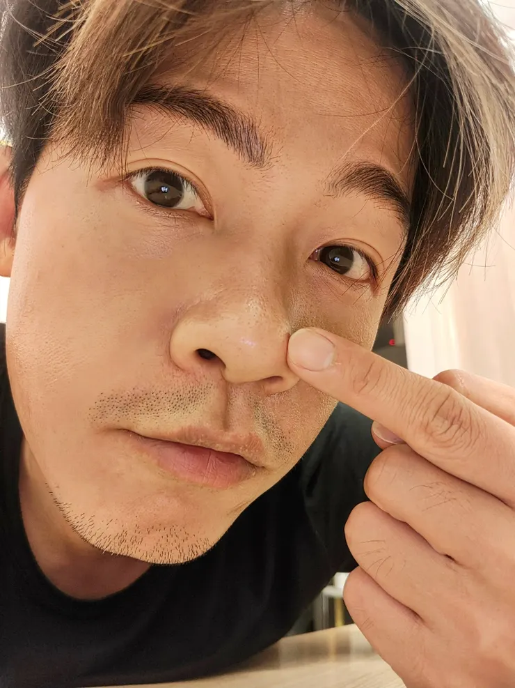 使用後實際膚況