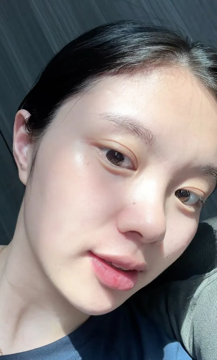 換季過敏怎麼辦？保養推薦