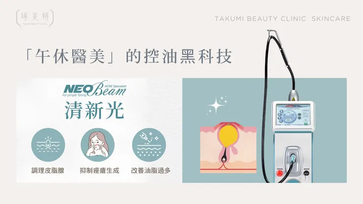 【術後全攻略】Neobeam 清新光會痛嗎？有沒有修復期？一篇文章幫你解惑