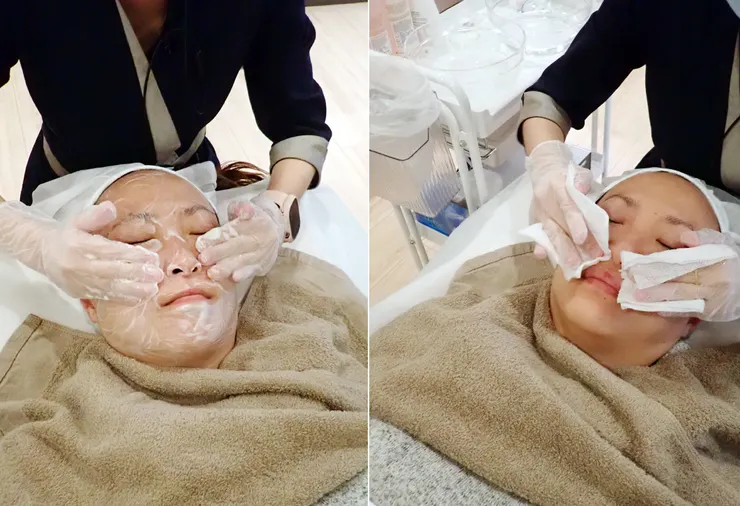 台北打皮秒│探索皮秒+蜂巢(超級鏡片ReFIX)-台北醫美診所推薦