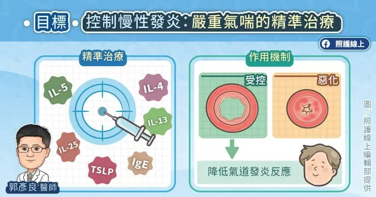 嚴重氣喘的精準治療