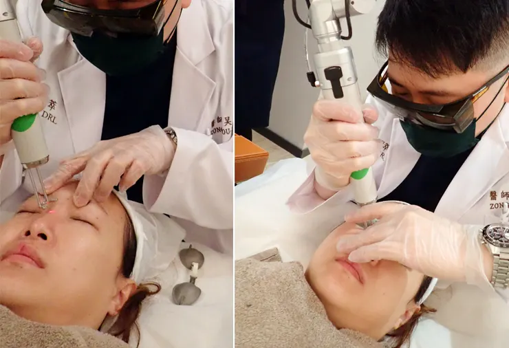 台北打皮秒│探索皮秒+蜂巢(超級鏡片ReFIX)-台北醫美診所推薦