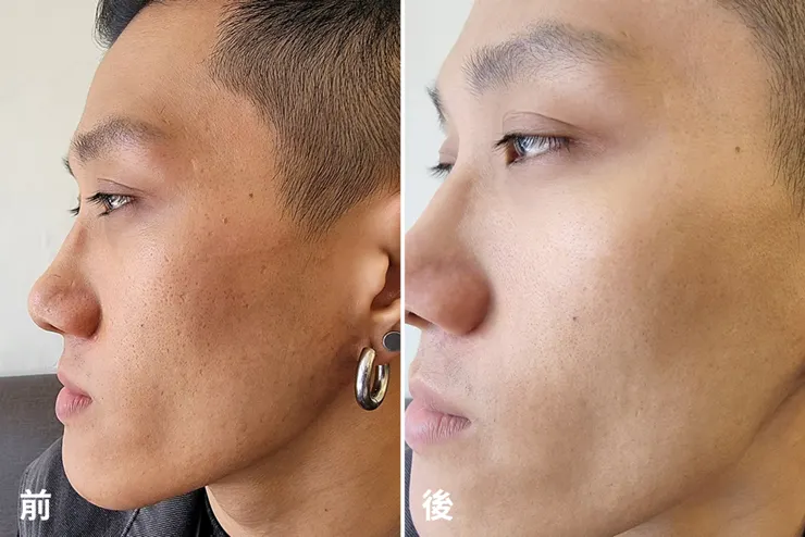 台南男生做臉推薦！男人的自我投資，告別油光滿面、痘痘粉刺，讓