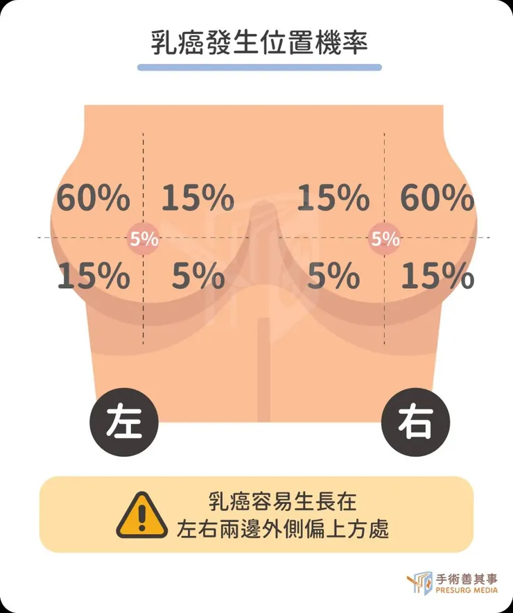 圖片來源：手術善其事