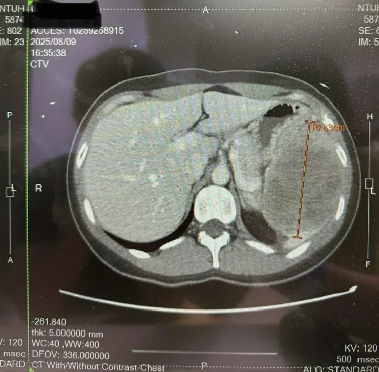CT掃描 橫切面