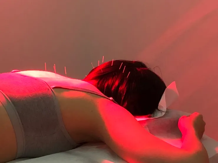 背上滿滿都是針