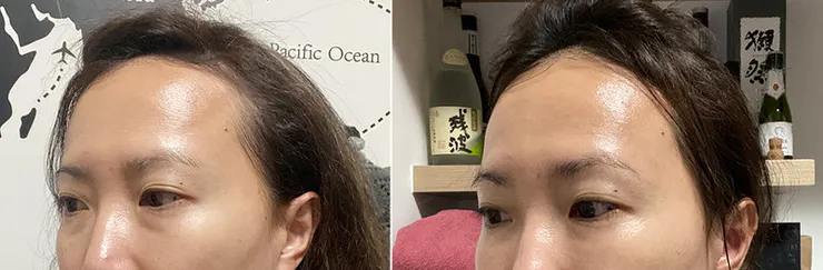 美容儀推薦│ZIIP HALO 好萊塢名人加持「掌上型」奈米微電流智能美膚管家