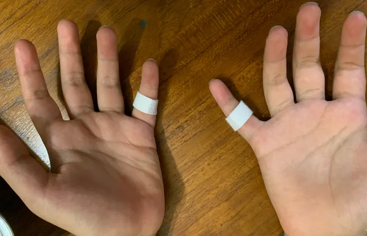 兒子兩隻受傷的小妞妞。