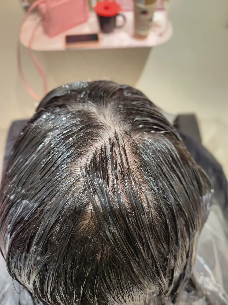 矯正頭頂與後頭部開旋位置