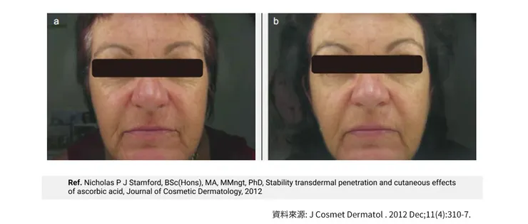 早C晚A 誰重要？兩大時機深入挑戰「早C好處」的保養計畫