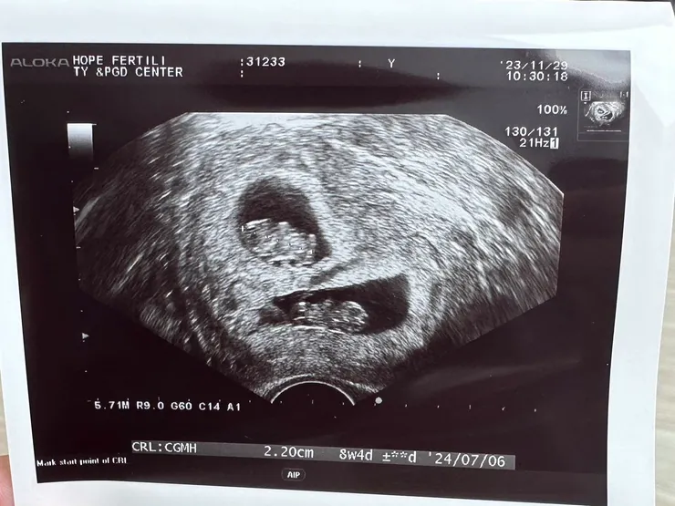 上面是B寶，下面是A寶