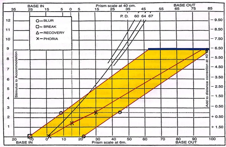 雙眼視機能異常 診斷與治療 第二版—陳振豪OD
