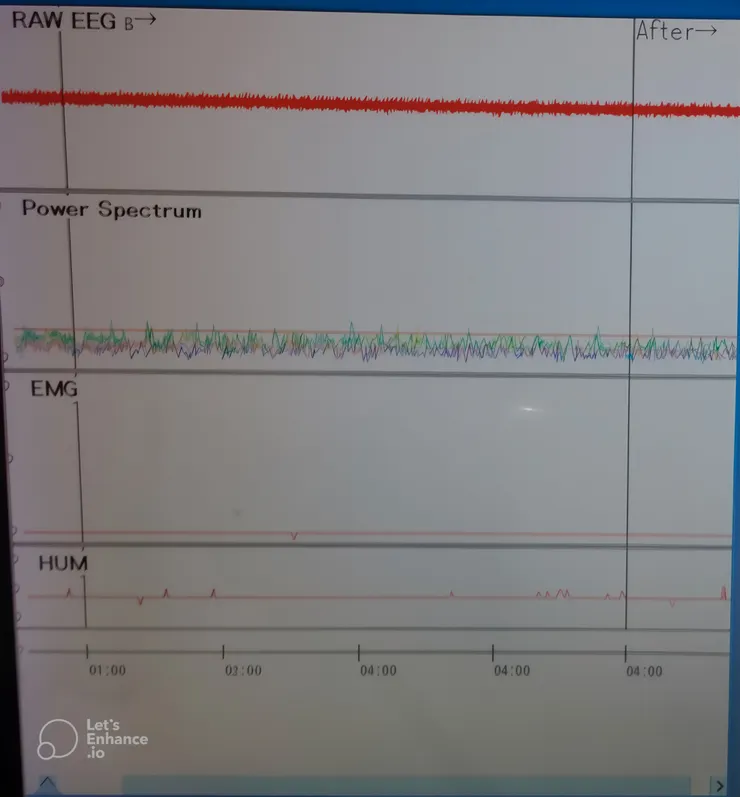 筆者曾研究過的腦電圖