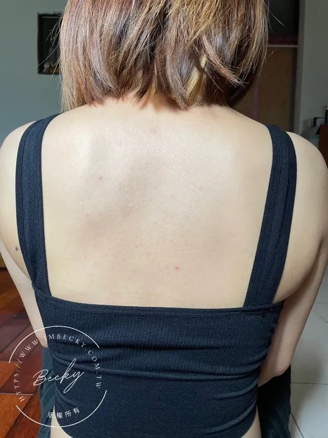 Laglow淨痘美體噴霧使用一週後