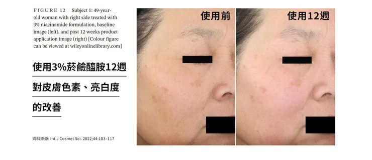 菸鹼醯胺(維他命B3)自然素顏美到發光!挑戰30天「菸鹼醯胺(維他命B3)」六大臉部保養功效大公開