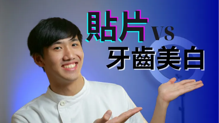 想做牙齒美白?冷光美白 vs. 牙齒貼片怎麼選?一篇看懂!