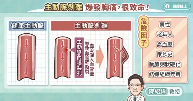 主動脈剝離爆發胸痛