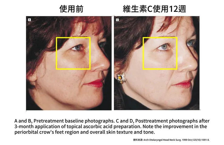 眼周保養成分怎麼選？