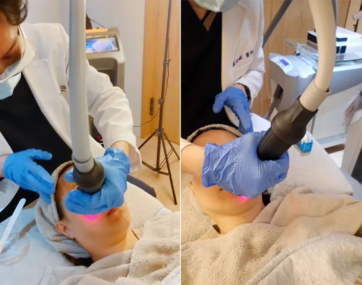 台北東區打雷射｜RedTouch PRO凍態雷射(果凍光)│台北打雷射推薦綻妍醫美診所