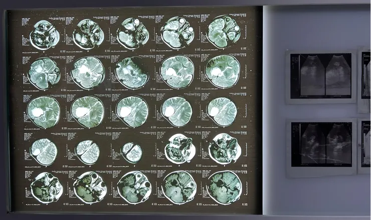 周慶輝，《應許之地：天使星》（之一）