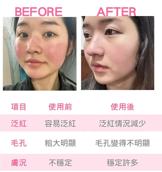 肌密青春原液使用對比