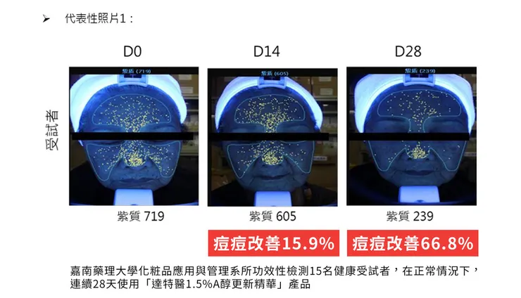 「A醇」現代抗老神器！