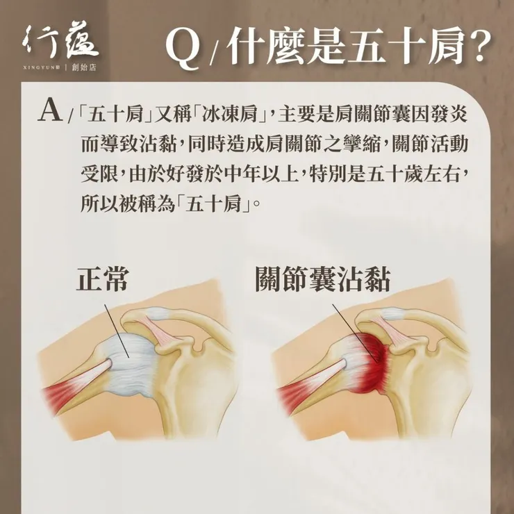 行蘊QA|什麼是五十肩