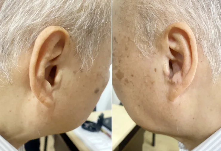 濰樂聽力中心居家到府服務