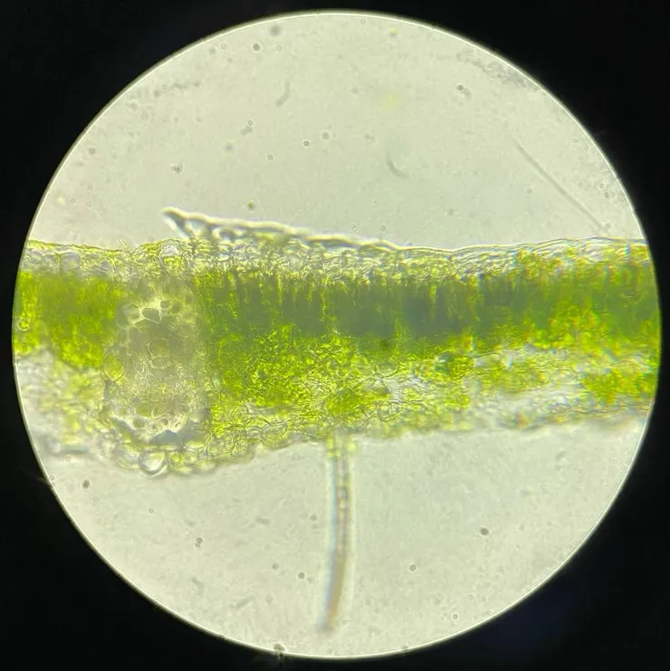 Cross Section of leaf of Cassia bakeriana (400x)