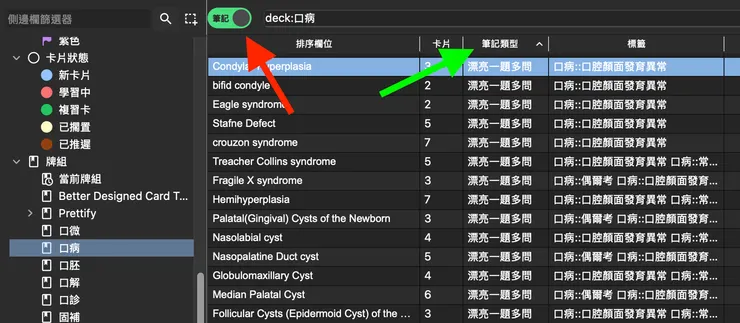 Anki 介面(筆記介面)