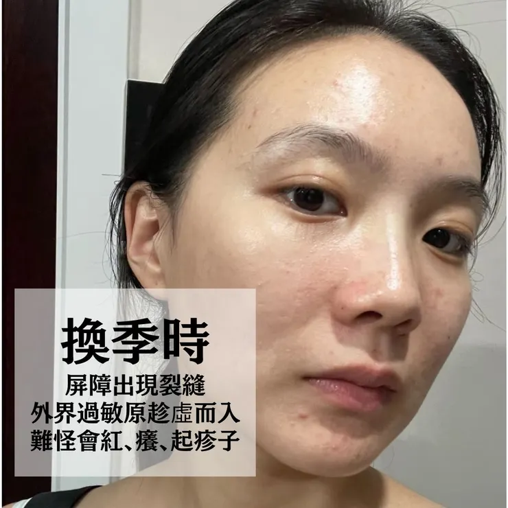 換季為什麼容易過敏